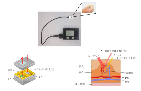 国立大学法人九州大学・Palmens株式会社との「MEMSマイクロ血流量センサ」製品化に向けた共同開…